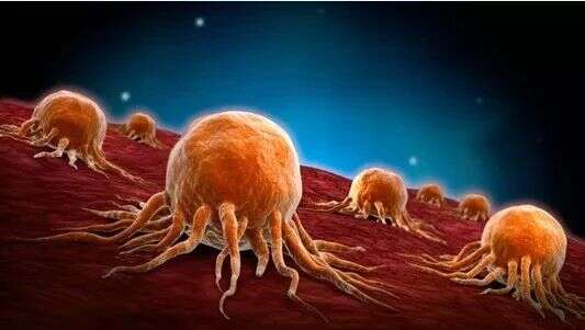 CANCER RES:靶向定量蛋白质组学,揭示黑色素瘤转移“凶手”