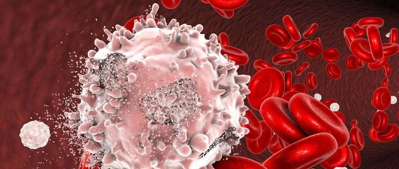 Blood:斩断白血病“病根” ,德国科学家报道白血病干细胞独特分子特性