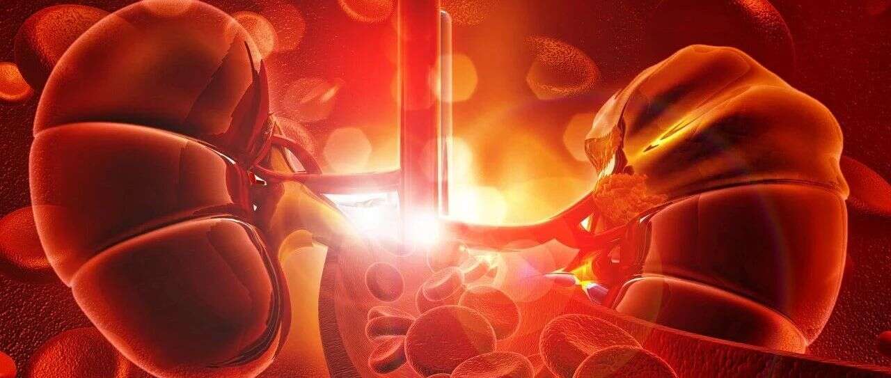 EMBO reports | 广东省人民医院余学清团队蛋白组学研究揭示Smad4促进糖尿病肾病新机制