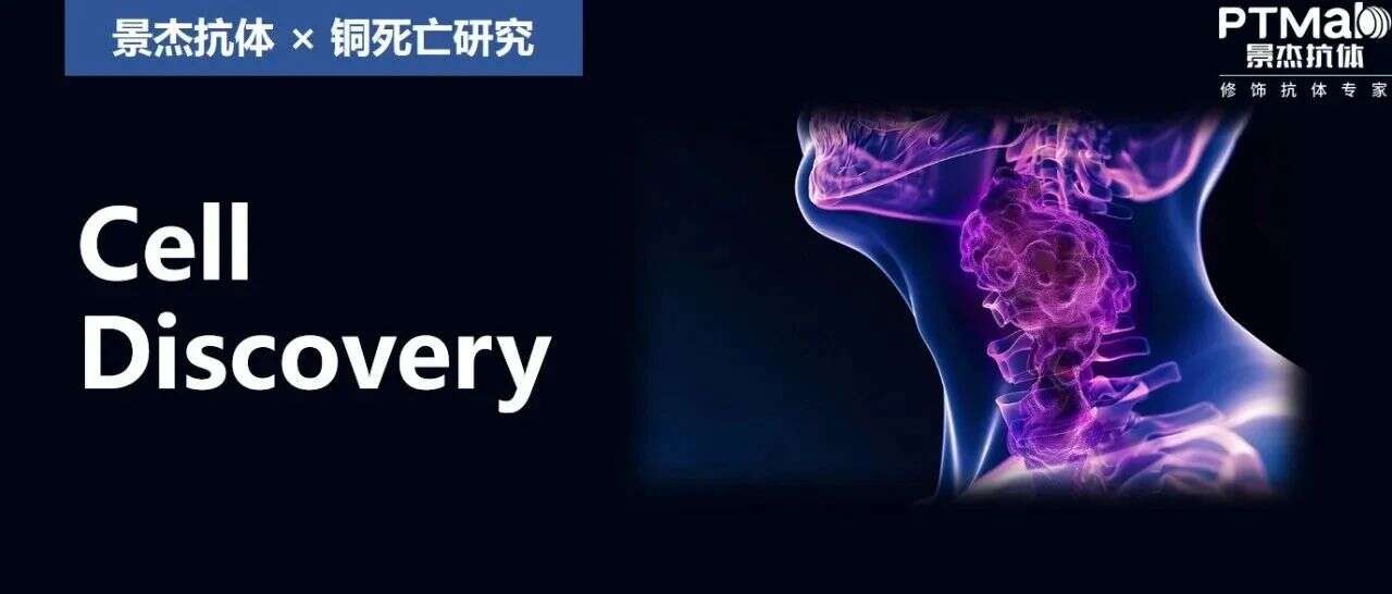 Cell Discov | 中肿再添新作:乳酰化修饰赋予肿瘤细胞铜死亡抗性