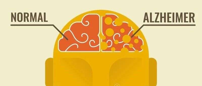 脑海中的橡皮擦,蛋白质组学让阿尔兹海默症研究“从容面对”【景杰精选】第02期