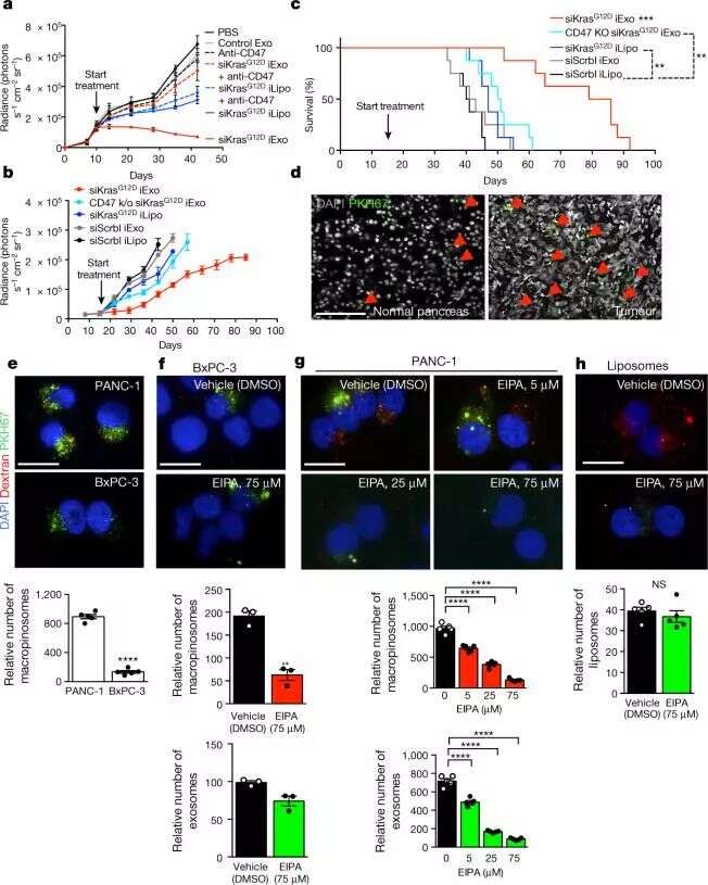 精准医疗新纪元—外泌体介导的RNAi用于胰腺癌治疗